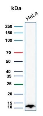 S100A4/Metastasin/Calvasculin (Marker of Tumor Metastasis) Antibody in Western Blot (WB)