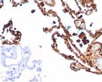 S100A4/Metastasin/Calvasculin (Marker of Tumor Metastasis) Antibody in Immunohistochemistry (Paraffin) (IHC (P))