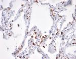 S100A4/Metastasin/Calvasculin (Marker of Tumor Metastasis) Antibody in Immunohistochemistry (Paraffin) (IHC (P))