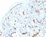 S100A4/Metastasin/Calvasculin (Marker of Tumor Metastasis) Antibody in Immunohistochemistry (Paraffin) (IHC (P))