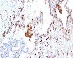 S100A4/Metastasin/Calvasculin (Marker of Tumor Metastasis) Antibody in Immunohistochemistry (Paraffin) (IHC (P))