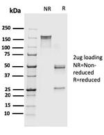 S100A4/Metastasin/Calvasculin Antibody in SDS-PAGE (SDS-PAGE)