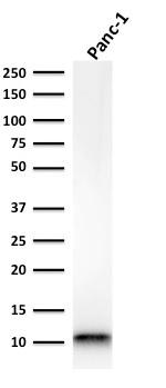 S100A4/Metastasin/Calvasculin Antibody in Western Blot (WB)