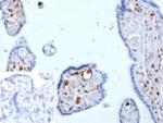 S100A4/Metastasin/Calvasculin (Marker of Tumor Metastasis) Antibody in Immunohistochemistry (Paraffin) (IHC (P))