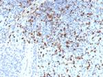 S100A4/Metastasin/Calvasculin (Marker of Tumor Metastasis) Antibody in Immunohistochemistry (Paraffin) (IHC (P))