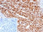 S100A4/Metastasin/Calvasculin (Marker of Tumor Metastasis) Antibody in Immunohistochemistry (Paraffin) (IHC (P))