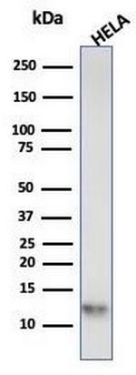 S100A4/Metastasin/Calvasculin (Marker of Tumor Metastasis) Antibody in Western Blot (WB)