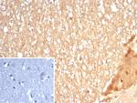 S100A5 Antibody in Immunohistochemistry (Paraffin) (IHC (P))