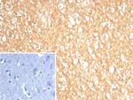 S100A5 Antibody in Immunohistochemistry (Paraffin) (IHC (P))
