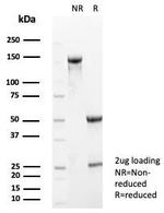 S100A5 Antibody in Immunohistochemistry (Paraffin) (IHC (P))