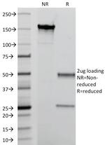 Calprotectin/MRP14/S100A9/Calgranulin B Antibody in SDS-PAGE (SDS-PAGE)