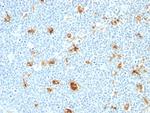 Calprotectin/MRP14/S100A9/Calgranulin B Antibody in Immunohistochemistry (Paraffin) (IHC (P))