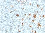 Calprotectin/MRP14/S100A9/Calgranulin B Antibody in Immunohistochemistry (Paraffin) (IHC (P))