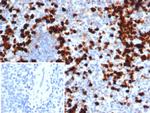 Calprotectin/MRP14/S100A9/Calgranulin B Antibody in Immunohistochemistry (Paraffin) (IHC (P))