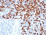 Calprotectin/MRP14/S100A9/Calgranulin B Antibody in Immunohistochemistry (Paraffin) (IHC (P))