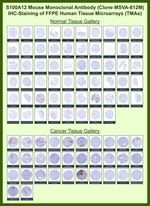 S100A12/CGRP Monoclonal Antibody (MSVA-812M)