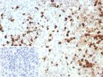 S100A12/CGRP Recombinant Rabbit Monoclonal Antibody (S100A12/8952R)