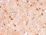 S100B (Astrocyte and Melanoma Marker) Antibody in Immunohistochemistry (Paraffin) (IHC (P))