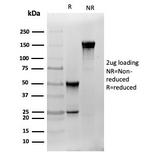 S100B (Astrocyte and Melanoma Marker) Antibody in SDS-PAGE (SDS-PAGE)