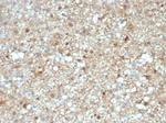 S100B (Astrocyte and Melanoma Marker) Monoclonal Antibody (S100B/4143)