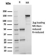 S100B (Astrocyte and Melanoma Marker) Antibody in Immunoelectrophoresis (IE)