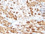 S100B (Astrocyte and Melanoma Marker) Antibody in Immunohistochemistry (Paraffin) (IHC (P))