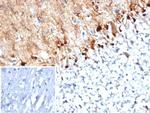 S100B (Astrocyte and Melanoma Marker) Antibody in Immunohistochemistry (Paraffin) (IHC (P))