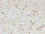 S100B (Astrocyte and Melanoma Marker) Antibody in Immunohistochemistry (Paraffin) (IHC (P))