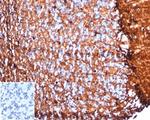 S100B (Astrocyte and Melanoma Marker) Antibody in Immunohistochemistry (Paraffin) (IHC (P))