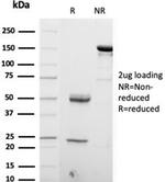 S100B (Astrocyte and Melanoma Marker) Antibody in SDS-PAGE (SDS-PAGE)