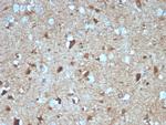 S100B (Astrocyte and Melanoma Marker) Monoclonal Antibody (S100B/4139)