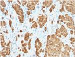 S100B Recombinant Rabbit Monoclonal Antibody (S100B, 1706R)