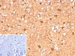 S100B (Astrocyte and Melanoma Marker) Recombinant Rabbit Monoclonal Antibody (S100B/12587R)