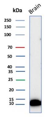 S100B (Astrocyte and Melanoma Marker) Antibody in Western Blot (WB)