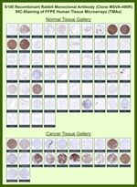 S100B (Astrocyte and Melanoma Marker) Antibody in Immunohistochemistry (Paraffin) (IHC (P))