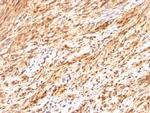 S100B (Astrocyte and Melanoma Marker) Antibody in Immunohistochemistry (Paraffin) (IHC (P))