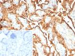 S100P/MIG9 Recombinant Mouse Monoclonal Antibody (rS100P/9254)