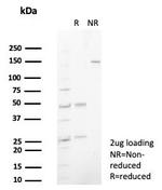 S100P/MIG9 Antibody in SDS-PAGE (SDS-PAGE)