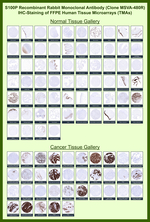 S100P Recombinant Rabbit Monoclonal Antibody (MSVA-480R)