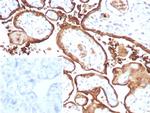 S100P/MIG9 Recombinant Rabbit Monoclonal Antibody (S100P/9135R)