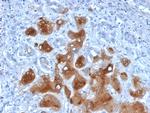 Serum Amyloid A Monoclonal Antibody (SAA/326)