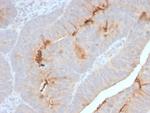 Serum Amyloid A Recombinant Rabbit Monoclonal Antibody (SAA, 2868R)