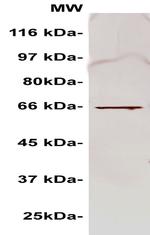 AEG1 Antibody in Western Blot (WB)