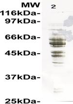 CCZ1 Antibody in Western Blot (WB)