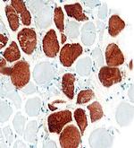Dystrophin Antibody in Immunohistochemistry (Paraffin) (IHC (P))