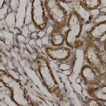 L1CAM Antibody in Immunohistochemistry (Paraffin) (IHC (P))