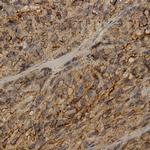ECRG4 Antibody in Immunohistochemistry (Paraffin) (IHC (P))