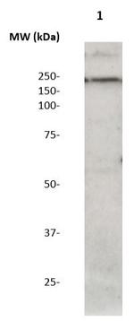 Phospho-LRRK2 (Ser973) Antibody in Western Blot (WB)