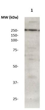 LRRK2 Antibody in Western Blot (WB)
