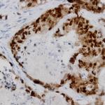 TOR2A Antibody in Immunohistochemistry (Paraffin) (IHC (P))